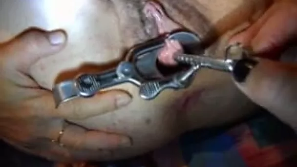 Spreading the dirty big pussy of my GF with a vaginal speculum