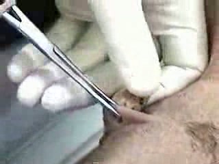 Getting Pussy Piercing