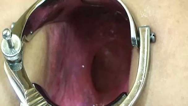 Metal speculum stretches my wife's loose asshole