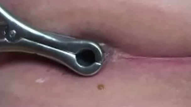 Stretching my girlfriend's tight asshole with metal speculum
