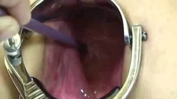 I stretched my wife's anus with speculum and poked her gut with a stick